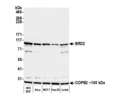 <b>Independent Antibodies Validation. </b>Western Blot: BRD2 Antibody (12C2E4) [NBP2-14861] - Whole cell lysate (50 µg) from HEK293T, HeLa, MCF-7,Hep-G2, and Jurkat cells prepared using NETN lysis buffer.Antibody: Mouse anti-BRD2 monoclonal antibody [12C2E4] used at 1:1000. Secondary: HRP conjugated goat anti-mouse IgG. Chemiluminescence with an exposure time of 30 seconds.Lower Panel: Rabbit anti-COPB2 antibody .