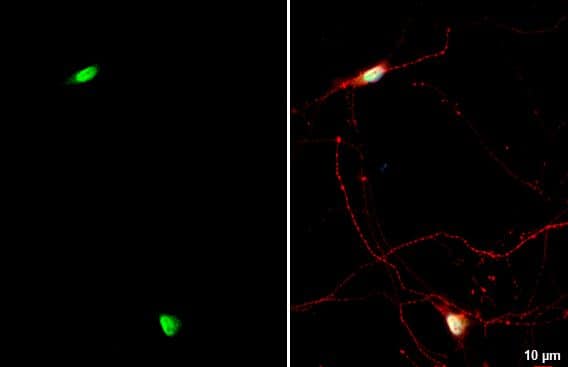 Immunocytochemistry/ Immunofluorescence NFIX Antibody