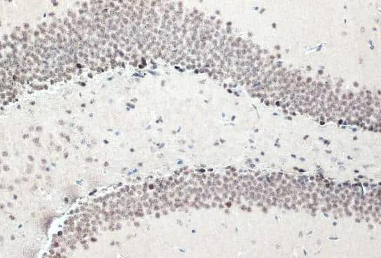 Immunohistochemistry-Paraffin: NFIX Antibody [NBP2-15038] -  Mouse hippocampus. NFIX stained by NFIX antibody [N2C2], Internal diluted at 1:2000. Antigen Retrieval: Citrate buffer, pH 6.0, 15 min.