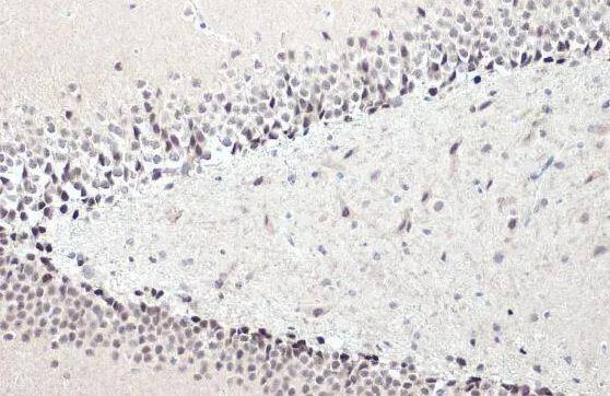 Immunohistochemistry-Paraffin: NFIX Antibody [NBP2-15038] - Rat hippocampus. NFIX stained by NFIX antibody [N2C2], Internal diluted at 1:2000. Antigen Retrieval: Citrate buffer, pH 6.0, 15 min.