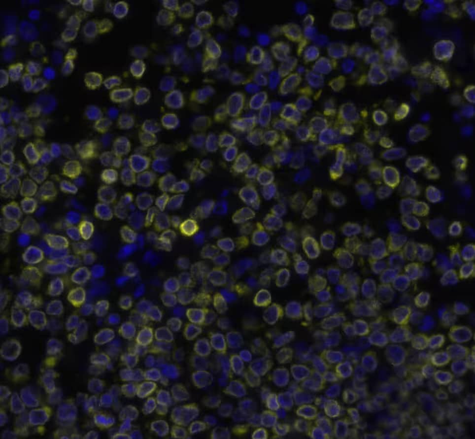 BCL2 was detected in immersion fixed paraffin-embedded sections of human Non-Hodgkin’s Lymphoma using Mouse Anti-Human BCL2, Monoclonal Antibody (Catalog #NBP2-15200) at a 1:500 dilution at 37 ° Celsius for 4 minutes. Before incubation with the primary antibody, tissue underwent an all-in-one dewaxing and antigen retrieval preprocessing using PreTreatment Module (PT Module) and Dewax and HIER Buffer H (pH 9; Epredia Catalog # TA-999-DHBH). TTissue was stained using the Alexa Fluor™ 647 Goat anti-Mouse IgG Secondary Antibody at 1:200 at 37 ° Celsius for 2 minutes. (Yellow; Lunaphore Catalog # DR647MS) and counterstained with DAPI (blue; Lunaphore Catalog # DR100). Specific staining was localized to the membrane. Protocol available in COMET™ Panel Builder.