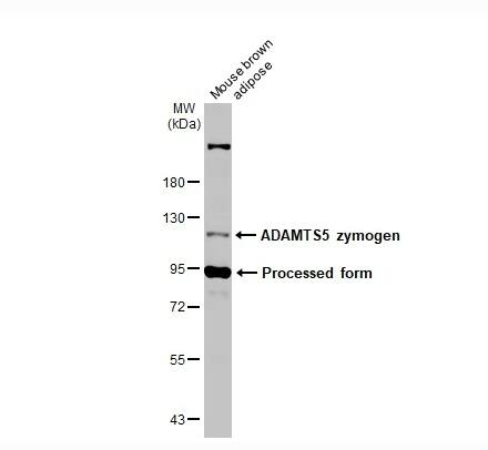 Western Blot ADAMTS5 Antibody - BSA Free