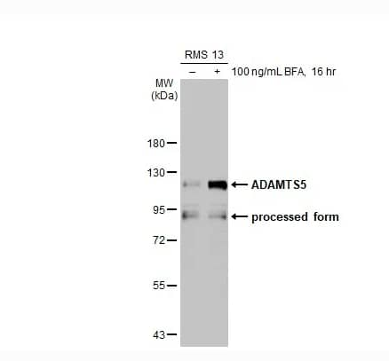 Western Blot ADAMTS5 Antibody - BSA Free