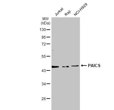 Western Blot: ADE2 Antibody [NBP2-15290] -Various tissue extracts (30 μg) were separated by 10% SDS-PAGE, and the membrane was blotted with PAICS antibody [N1C1] diluted at 1:10000. The HRP-conjugated anti-rabbit IgG antibody (NBP2-19301) was used to detect the primary antibody.