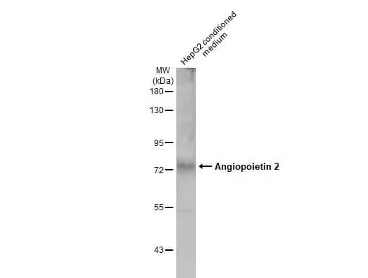 Western Blot: Angiopoietin-2 Antibody [NBP2-15385] - HepG2 conditioned medium (30 ug) was separated by 7.5% SDS-PAGE, and the membrane was blotted with Angiopoietin 2 antibody diluted at 1:5000. The HRP-conjugated anti-rabbit IgG antibody (NBP2-19301 was used to detect the primary antibody.