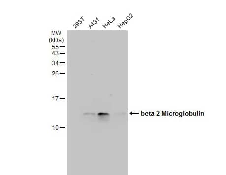 Western Blot: beta 2-Microglobulin Antibody [NBP2-15566] - Various whole cell extracts (30 μg) were separated by 15% SDS-PAGE, and the membrane was blotted with beta 2 Microglobulin antibody diluted at 1:5000. The HRP-conjugated anti-rabbit IgG antibody (NBP2-19301) was used to detect the primary antibody.