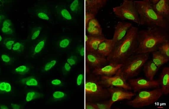 ICC/IF-BRD9 Antibody [NBP2-15614] -A549 cells were fixed in 4% paraformaldehyde at RT for 15 min. Green: BRD9 stained by BRD9 antibody diluted at 1:500. Red: alpha Tubulin, a cytoskeleton marker, stained by alpha Tubulin antibody [114]  diluted at 1:1000.