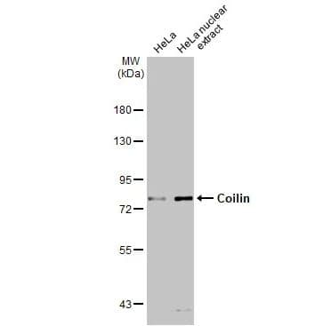 Western Blot: Coilin Antibody [NBP2-15939] - HeLa whole cell and nuclear extracts (30 ug) were separated by 7.5% SDS-PAGE, and the membrane was blotted with Coilin antibody diluted at 1:1500. The HRP-conjugated anti-rabbit IgG antibody (NBP2-19301) was used to detect the primary antibody.