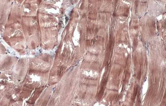 Immunohistochemistry-Paraffin-Creatine Kinase MM Antibody [NBP2-16003] - Cat muscle.Creatine kinase (muscle) stained by Creatine kinase (muscle) antibody diluted at 1:1000.Antigen Retrieval: Citrate buffer, pH 6.0, 15 min.