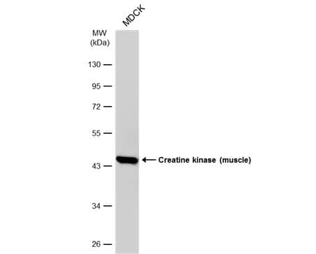 Western Blot: Creatine Kinase MM Antibody [NBP2-16003] - Whole cell extract (30 ug) was separated by 10% SDS-PAGE, and the membrane was blotted with Creatine kinase (muscle) antibody diluted at 1:1000. The HRP-conjugated anti-rabbit IgG antibody antibody (NBP2-19301) was used to detect the primary antibody.