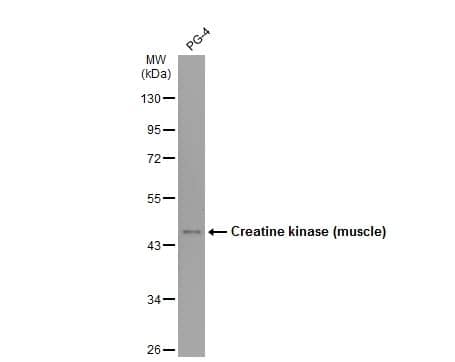 Western Blot: Creatine Kinase MM Antibody [NBP2-16003] - Whole cell extract (30 ug) was separated by 10% SDS-PAGE, and the membrane was blotted with Creatine kinase (muscle) antibody diluted at 1:1000. The HRP-conjugated anti-rabbit IgG antibody antibody (NBP2-19301) was used to detect the primary antibody.