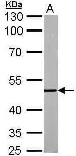 Western Blot: DCP2 Antibody [NBP2-16109] -A. 30 μg 24hr whole zebrafish lysate/extract10 % SDS-PAGEDCP2 antibody dilution: 1:500