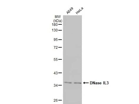 Western Blot: DNASE1L3 Antibody [NBP2-16198] -Various whole cell extracts (30 μg) were separated by 10% SDS-PAGE, and the membrane was blotted with DNase IL3 antibody [N3C3] diluted at 1:20000. The HRP-conjugated anti-rabbit IgG antibody (NBP2-19301) was used to detect the primary antibody.