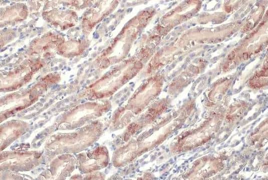 Immunohistochemistry-Paraffin: epithelial Sodium Channel alpha Antibody [NBP2-16353] -Mouse kidney.ENaC Alpha stained by ENaC Alpha antibody [N3C2], Internal diluted at 1:500.Antigen Retrieval: Citrate buffer, pH 6.0, 15 min.