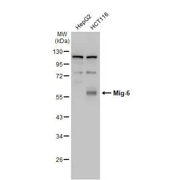Western Blot: ERRFI1 Antibody [NBP2-16372] -Various whole cell extracts (30 ug) were separated by 10% SDS-PAGE, and the membrane was blotted with Mig-6 antibody [N1C1] diluted at 1:1000. The HRP-conjugated anti-rabbit IgG antibody (NBP2-19301) was used to detect the primary antibody.