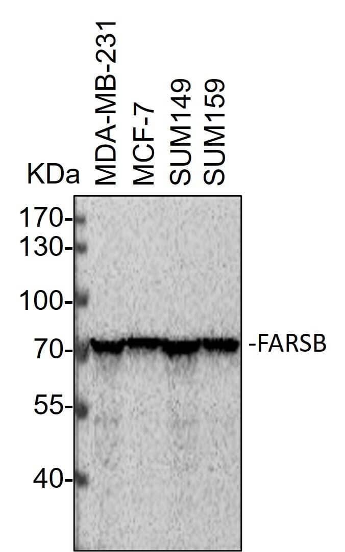 Western Blot: Rabbit Polyclonal FARSB Antibody [NBP2-16430] - Whole cell lysates from MDA-MB-231, MCF-7, SUM149 and SUM159 cells were loaded with 50 ug/lane. 10% SDS-PAGE. FARSB Antibody (NBP2-16430) was used for primary antibody: 1:1000, 4℃, overnight. Image from a verified customer review.