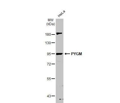 Western Blot Glycogen phosphorylase, muscle form Antibody