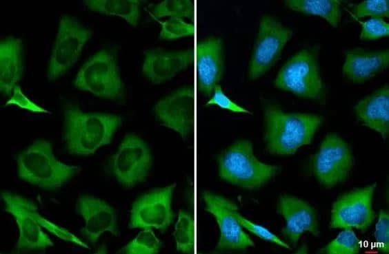 Immunocytochemistry/Immunofluorescence: GSPT1 Antibody [NBP2-16754] -HeLa cells were fixed in 4% paraformaldehyde at RT for 15 min. Green: GSPT1 stained by GSPT1 antibody diluted at 1:500.Blue: Fluoroshield with DAPI. 