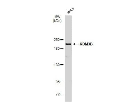 Western Blot: JMJD1B Antibody [NBP2-17007] - Whole cell extract (30 ug) was separated by 5% SDS-PAGE, and the membrane was blotted with KDM3B antibody [C2C3], C-term (GTX116198) diluted at 1:1000. The HRP-conjugated anti-rabbit IgG antibody (NBP2-19301) was used to detect the primary antibody.