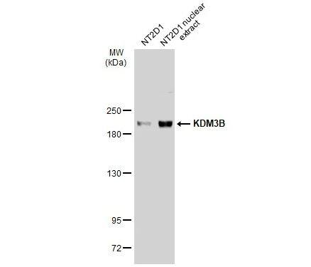 Western Blot: JMJD1B Antibody [NBP2-17007] -NT2D1 whole cell and nuclear extracts (30 ug) were separated by 5% SDS-PAGE, and the membrane was blotted with KDM3B antibody [C2C3], C-term diluted at 1:1000. The HRP-conjugated anti-rabbit IgG antibody (NBP2-19301 was used to detect the primary antibody.