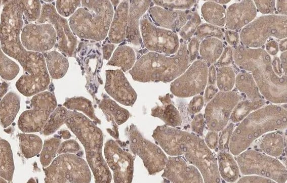 Immunohistochemistry-Paraffin: Lipase A Antibody [NBP2-19360] -Mouse kidney.LAL stained by LAL antibody [N3C3] diluted at 1:500.Antigen Retrieval: Citrate buffer, pH 6.0, 15 min