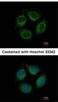 Analysis of methanol-fixed MCF-7, using Netrin G1 ligand antibody at 1:500 dilution.