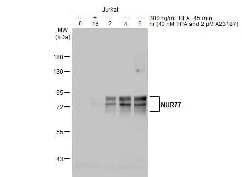 Western Blot: NGFI-B alpha/Nur77/NR4A1 Antibody [NBP2-19613] -Untreated and treated Jurkat whole cell extracts (30 ug) were separated by 7.5% SDS-PAGE, and the membrane was blotted with NUR77 antibody diluted at 1:500. The HRP-conjugated anti-rabbit IgG antibody (NBP2-19301)) was used to detect the primary antibody.