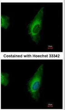  Analysis of methanol-fixed HeLa, using ORP8 antibody at 1:500 dilution.