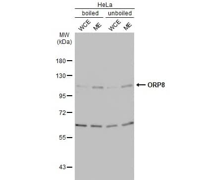 Western Blot ORP8 Antibody