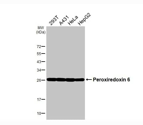 Various whole cell extracts (30 μg) were separated by 12% SDS-PAGE, and the membrane was blotted with Peroxiredoxin 6 antibody diluted at 1:1000. The HRP-conjugated anti-rabbit IgG antibody (NBP2-19301) was used to detect the primary antibody.