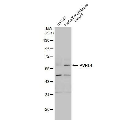 Western Blot: Nectin-4/PVRL4 Antibody [NBP2-20014] -HaCaT whole cell and membrane extracts (30 ug) were separated by 10% SDS-PAGE, and the membrane was blotted with PVRL4 antibody [N1C1] diluted at 1:1000. The HRP-conjugated anti-rabbit IgG antibody (NBP2-19301) was used to detect the primary antibody.