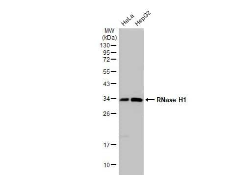 Various whole cell extracts (30 μg) were separated by 12% SDS-PAGE, and the membrane was blotted with RNase H1 antibody [N2C3]  diluted at 1:1000. The HRP-conjugated anti-rabbit IgG antibody (NBP2-19301) was used to detect the primary antibody.