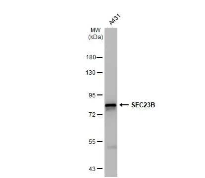 Western Blot: SEC23B Antibody [NBP2-20279] - Whole cell extract (30 ug) was separated by 7.5% SDS-PAGE, and the membrane was blotted with SEC23B antibody [N1N2], N-term diluted at 1:5000. The HRP-conjugated anti-rabbit IgG antibody (NBP2-19301) was used to detect the primary antibody.