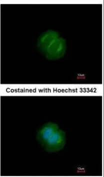 Analysis of paraformaldehyde-fixed MCF-7, using Tankyrase antibody at 1:200 dilution.