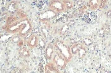 Immunohistochemistry-Paraffin ZNF598 Antibody - Azide Free