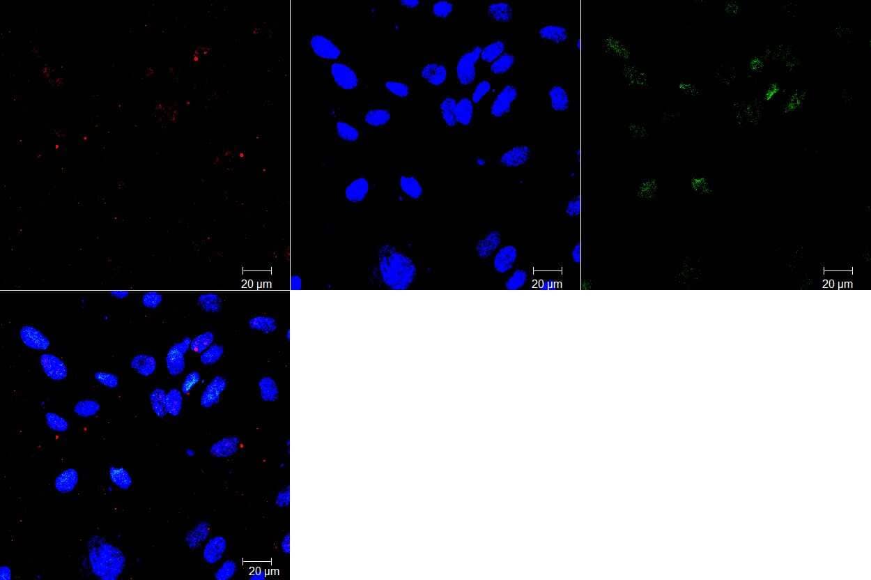 Immunocytochemistry/Immunofluorescence: Mouse Monoclonal ABCG2/CD338 Antibody (3G8) [NBP2-22124] - Human brain microvascular endothelial cells stained for cilia (red) and ABCG2 (green) and nuclear DAPI (blue). Image from a verified customer review.