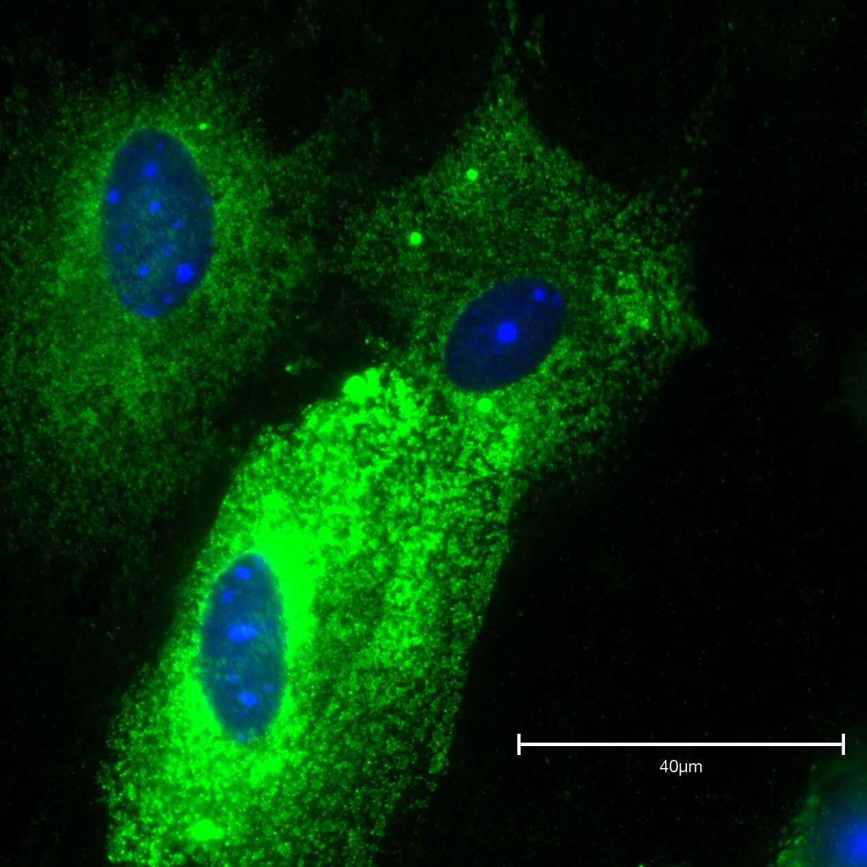 Immunocytochemistry/Immunofluorescence: Mouse Monoclonal Adiponectin/Acrp30 Antibody (19F1) [NBP2-22450] - Adipocytes isolated from the pelvic area of the male mouse. Image from a verified customer review.