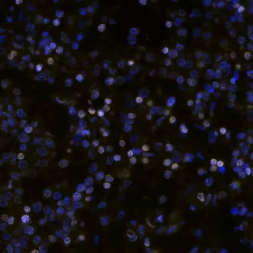 CCND1 was detected in immersion fixed paraffin-embedded sections of human Hodgkin’s Lymphoma using Rabbit Anti-Human CCND1, Monoclonal Antibody (Catalog #NBP2-24695) at 25ug/mL at 37 ° Celsius for 4 minutes. Before incubation with the primary antibody, tissue underwent an all-in-one dewaxing and antigen retrieval preprocessing using PreTreatment Module (PT Module) and Dewax and HIER Buffer H (pH 9; Epredia Catalog # TA-999-DHBH).Tissue was stained using the Alexa Fluor™ Plus 647 Goat anti-Rabbit IgG Secondary Antibody at 1:200 at 37 ° Celsius for 2 minutes. (Yellow; Lunaphore Catalog # DR647RB) and counterstained with DAPI (blue; Lunaphore Catalog # DR100). Specific staining was localized to the nucleus. Protocol available in COMET™ Panel Builder.