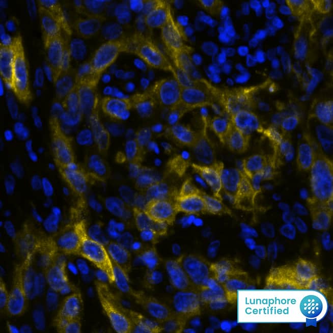 CD73 was detected in immersion fixed paraffin-embedded sections of human cervical cancer using Mouse Anti-Human CD73 Monoclonal Antibody (Novus Catalog # NBP2-25237) at 1:200 at 37 ° Celsius for 4 minutes. Before incubation with the primary antibody, tissue underwent an all-in-one dewaxing and antigen retrieval preprocessing using PreTreatment Module (PT Module) and Dewax and HIER Buffer H (pH 9). Tissue was stained using the Alexa Fluor™ 647 Goat anti-Mouse IgG Secondary Antibody at 1:200 at 37 ° Celsius for 2 minutes. (Yellow; Lunaphore Catalog # DR647MS) and counterstained with DAPI (blue; Lunaphore Catalog # DR100). Specific staining was localized to the cell membrane. Protocol available in COMET™ Panel Builder.