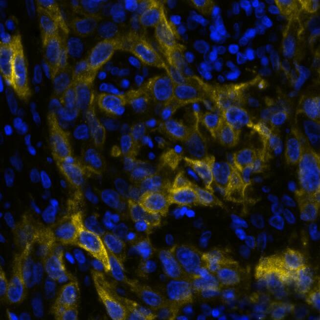 CD73 was detected in immersion fixed paraffin-embedded sections of human cervical cancer using Mouse Anti-Human CD73 Monoclonal Antibody (Novus Catalog # NBP2-25237) at 1:200 at 37 ° Celsius for 4 minutes. Before incubation with the primary antibody, tissue underwent an all-in-one dewaxing and antigen retrieval preprocessing using PreTreatment Module (PT Module) and Dewax and HIER Buffer H (pH 9). Tissue was stained using the Alexa Fluor™ 647 Goat anti-Mouse IgG Secondary Antibody at 1:200 at 37 ° Celsius for 2 minutes. (Yellow; Lunaphore Catalog # DR647MS) and counterstained with DAPI (blue; Lunaphore Catalog # DR100). Specific staining was localized to the cell membrane. Protocol available in COMET™ Panel Builder.