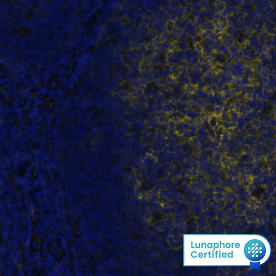 CD73 was detected in immersion fixed paraffin-embedded sections of human tonsil using Mouse Anti-Human CD73 Monoclonal Antibody (Novus Catalog # NBP2-25237 ) at 1:200 at 37 ° Celsius for 4 minutes. Before incubation with the primary antibody, tissue underwent an all-in-one dewaxing and antigen retrieval preprocessing using PreTreatment Module (PT Module) and Dewax and HIER Buffer H (pH 9). Tissue was stained using the Alexa Fluor™ 647 Goat anti-Mouse IgG Secondary Antibody at 1:200 at 37 ° Celsius for 2 minutes. (Yellow; Lunaphore Catalog # DR647MS) and counterstained with DAPI (blue; Lunaphore Catalog # DR100). Specific staining was localized to the cell membrane. Protocol available in COMET™ Panel Builder.