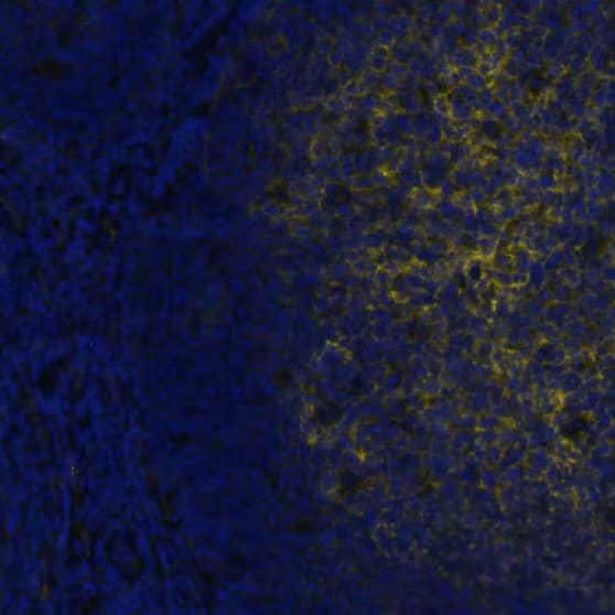 CD73 was detected in immersion fixed paraffin-embedded sections of human tonsil using Mouse Anti-Human CD73 Monoclonal Antibody (Novus Catalog # NBP2-25237 ) at 1:200 at 37 ° Celsius for 4 minutes. Before incubation with the primary antibody, tissue underwent an all-in-one dewaxing and antigen retrieval preprocessing using PreTreatment Module (PT Module) and Dewax and HIER Buffer H (pH 9). Tissue was stained using the Alexa Fluor™ 647 Goat anti-Mouse IgG Secondary Antibody at 1:200 at 37 ° Celsius for 2 minutes. (Yellow; Lunaphore Catalog # DR647MS) and counterstained with DAPI (blue; Lunaphore Catalog # DR100). Specific staining was localized to the cell membrane. Protocol available in COMET™ Panel Builder.
