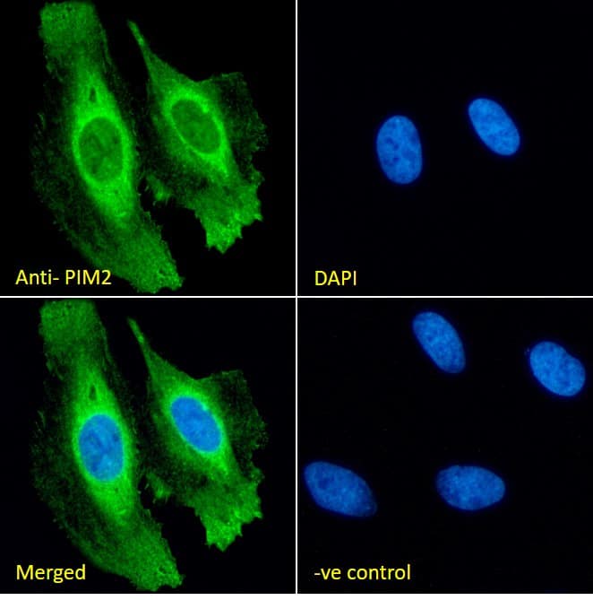 Immunocytochemistry/Immunofluorescence Goat Polyclonal PIM2 Antibody [NBP2-26114] - Immunofluorescence analysis of paraformaldehyde fixed HeLa cells, permeabilized with 0.15% Triton. Primary incubation 1hr (10ug/ml) followed by Alexa Fluor 488 secondary antibody (2ug/ml), showing cytoplasmic and membrane staining. The nuclear stain is DAPI (blue). Negative control: Unimmunized goat IgG (10ug/ml) followed by Alexa Fluor 488 secondary antibody (2ug/ml).