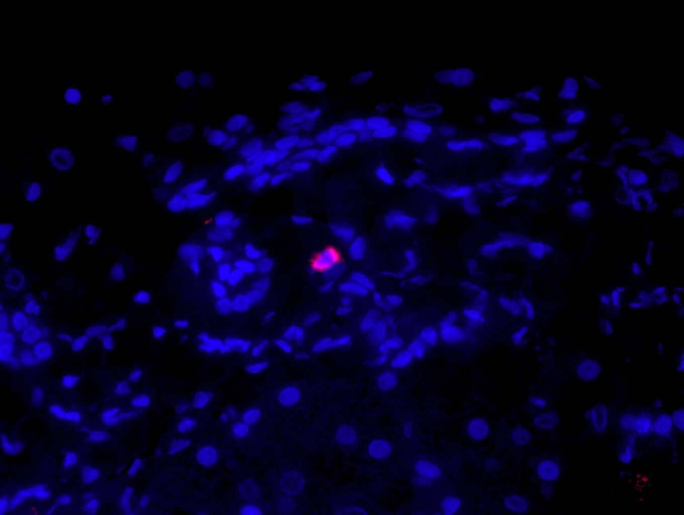 Immunohistochemistry-Paraffin Tryptase alpha/beta 1 Antibody (AA1)