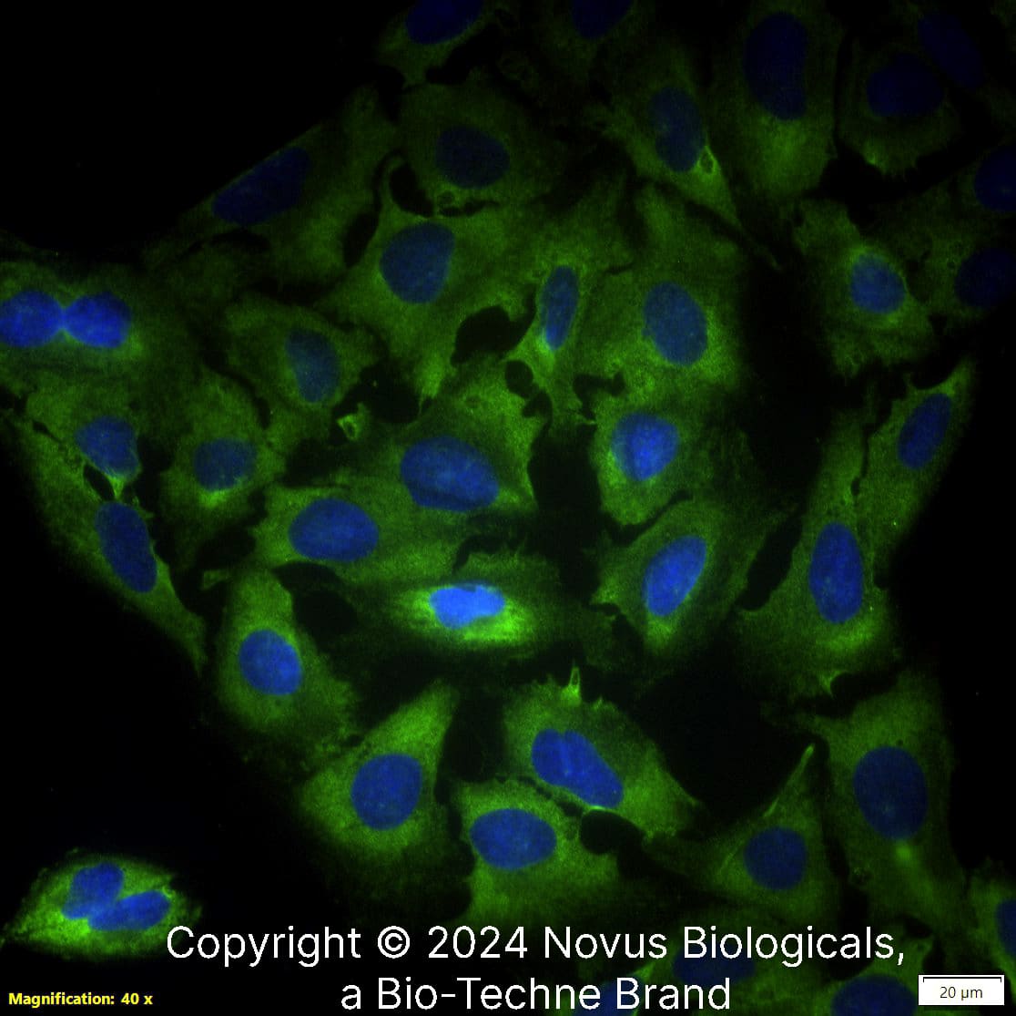 LIF (39N7D10) was detected in immersion fixed U-2 OS human osteosarcoma cell line using Rat anti-LIF (39N7D10) Protein G-purified Recombinant Monoclonal Antibody (Catalog # NBP2-27406) at 1.0 µg/mL overnight at 4C.  Cells were stained using DyLight 488-conjugated Anti-Rat IgG (H+L) Cross-Absorbed Secondary Antibody (green), and counterstained with DAPI (blue).  Cells were imaged using a 40X objective.