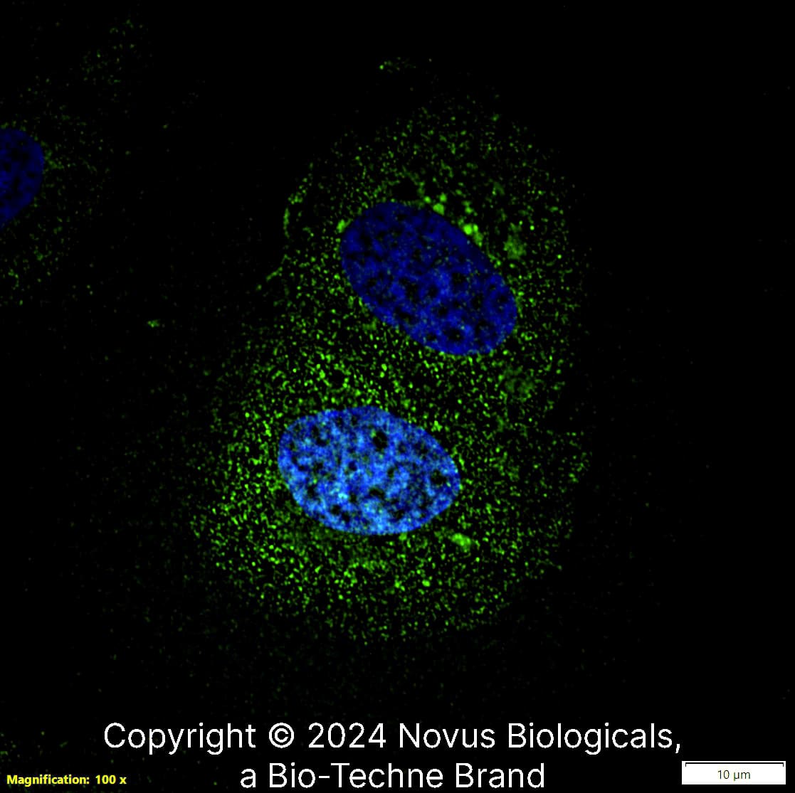 LIF (39N7D10) was detected in immersion fixed U-2 OS human osteosarcoma cell line using Rat anti-LIF (39N7D10) Protein G-purified Recombinant Monoclonal Antibody (Catalog # NBP2-27406) at 1.0 µg/mL overnight at 4C.  Cells were stained using DyLight 488-conjugated Anti-Rat IgG (H+L) Cross-Absorbed Secondary Antibody (green), and counterstained with DAPI (blue).  Cells were imaged using a 100X objective and digitally deconvolved.