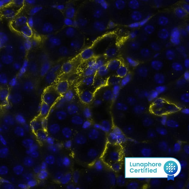 Cytokeratin, pan Antibody was detected in immersion fixed paraffin-embedded sections of mouse Kidney using Mouse Anti-Human/Mouse Cyokeratin, pan Monoclonal Antibody (Catalog #NBP2-29429) at 1:200 dilution at 37 ° Celsius for 4 minutes. Before incubation with the primary antibody, tissue underwent an all-in-one dewaxing and antigen retrieval preprocessing using PreTreatment Module (PT Module) and Dewax and HIER Buffer H (pH 9; Epredia Catalog # TA-999-DHBH).Tissue was stained using the Alexa Fluor™ 647 Goat anti-Mouse IgG Secondary Antibody at 1:200 at 37 ° Celsius for 2 minutes. (Yellow; Lunaphore Catalog # DR647MS) and counterstained with DAPI (blue; Lunaphore Catalog # DR100). Specific staining was localized to the membrane. Protocol available in COMET™ Panel Builder.