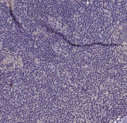 Immunohistochemistry-Paraffin: Lgi4 Antibody [NBP2-30423] -Staining of human lymph node shows no positivity in non-germinal center cells as expected.