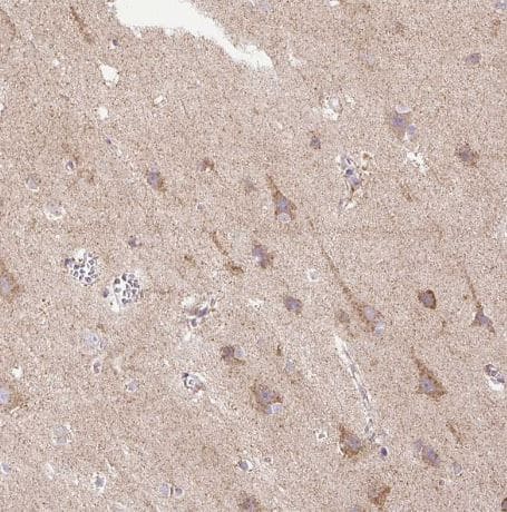 Immunohistochemistry-Paraffin TM2D3 Antibody - BSA Free