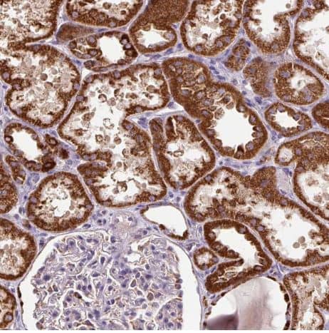 Immunohistochemistry-Paraffin TM2D3 Antibody - BSA Free